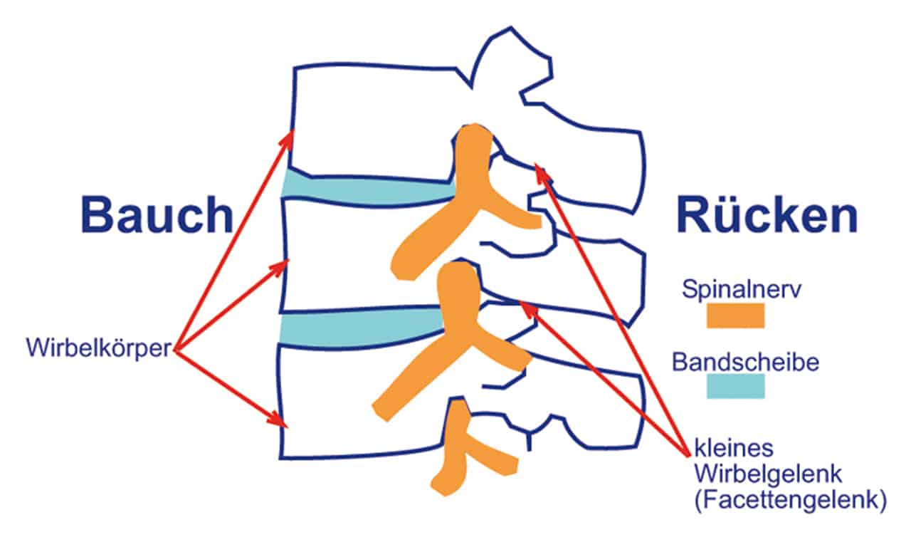 Wirbelsäule Bandscheiben Bandscheibenvorfälle
